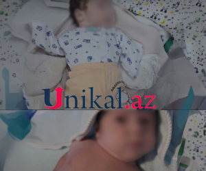 Sabunçuda qolları olmayan körpə doğulub, anası ondan imtina edib