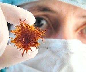 Azərbaycanda ilk dəfə xərçəng diaqnozu qoyulanların sayı 15 ildə 73% artıb