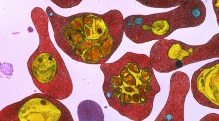 Immune children aid malaria vaccine hunt