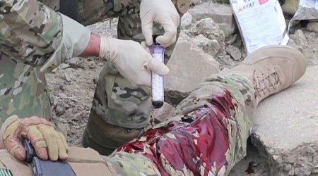 Tool can plug gunshot wounds in seconds