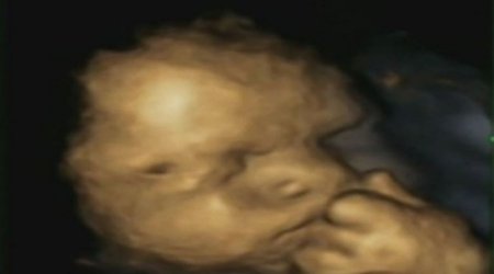 Is this picture proof that unborn babies feel mother's stress?