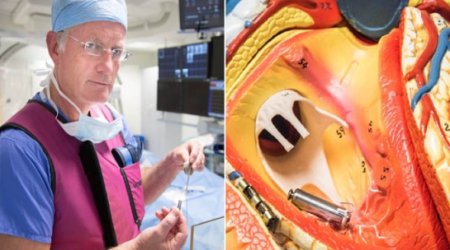 'World's smallest' pacemaker fitted for first time