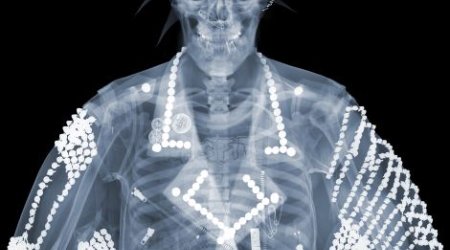 X-ray 'voyeur's' artwork provides a surprising glimpse... - PHOTO