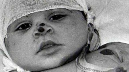 Erməni həkimin 45 il Azərbaycanda sürən gizli terroru