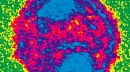 Kick and kill: is this the best new hope for an Aids cure?