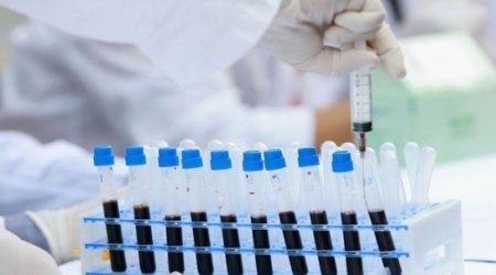 For the first time, scientists have literally edited HIV out of a human genome