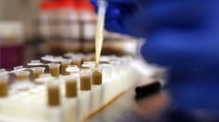 “Ebola”nın dərmanı tapıldı?