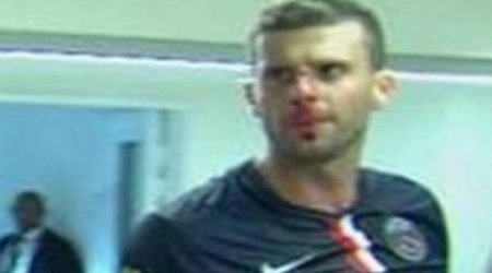 Thiago Motta head-butted