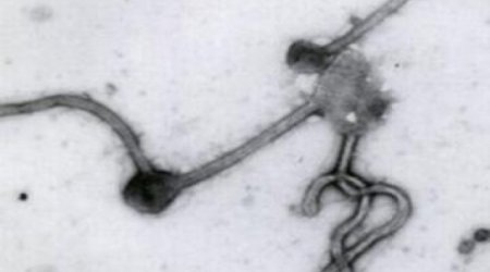 Several persons in Azerbaijan call “hotline” on suspicion of Ebola virus
