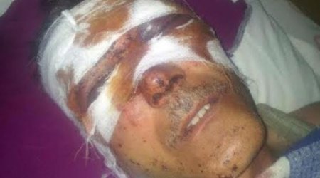 Beaten journalist of radio Liberty Ilgar Nasibov - PHOTOS