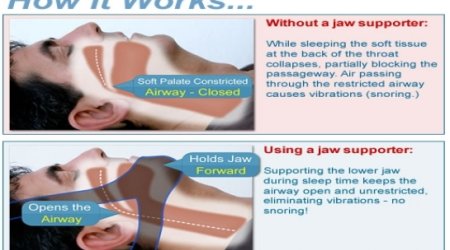 How to stop snoring and sleep well again