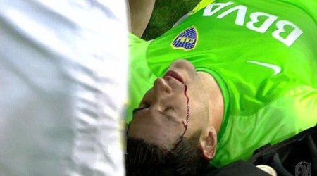 Goalkeeper struck by rock thrown by fans in shocking incident