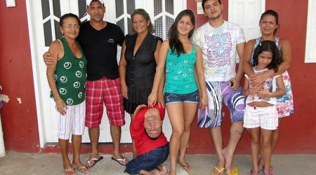 How baby born with the upside-down head becomes motivational speaker - PHOTO