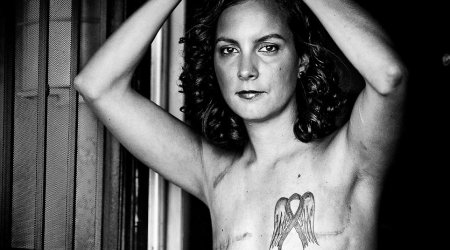 Scars of survival - PHOTO+VIDEO