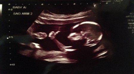 Is this the coolest baby ever?