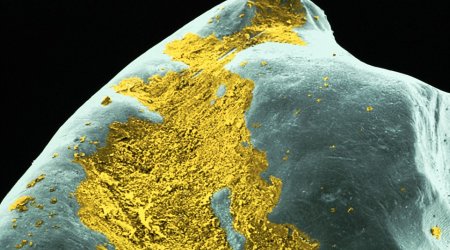 Gruesome 'alien invaders' are the bacteria lurking in the plaque on your TEETH - PHOTO