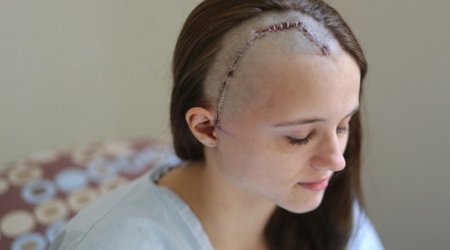 Assault victim reveals her horrific scars - VIDEO