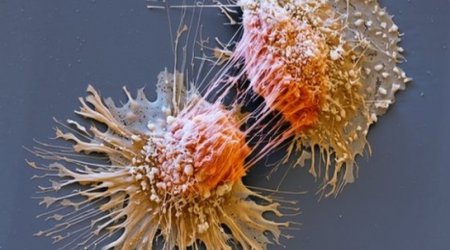 Cancer gene test 'would save lives'