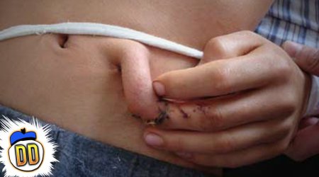 5 People with Extra Bodyparts - PHOTO+VIDEO