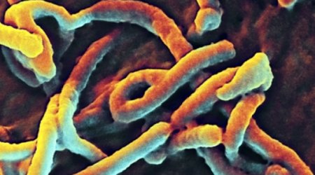 How to avoid catching Ebola