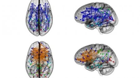 Men and women's brains are 'wired differently'