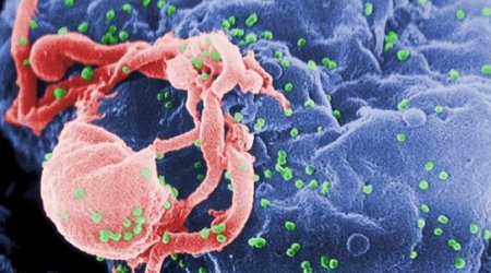 Scientists discover radiation 'bomb' that could wipe out HIV