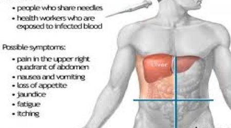 FDA approves faster, easier treatment for hepatitis C