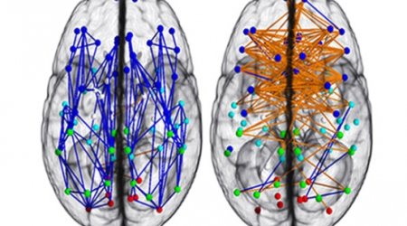 Sex and brains: Men and women are different