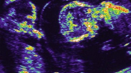 Exam grades 'more nature than nurture'