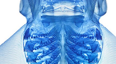 Scientist bleaches and dyes dead creatures to reveal their amazing inner anatomy - PHOTO