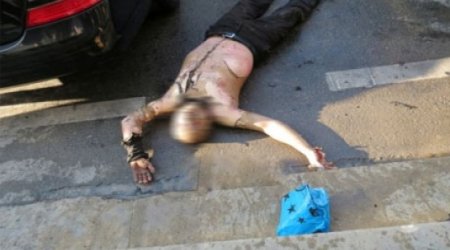 Health minister visits Azeri man who set himself alight