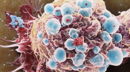 "Sticky balls" stop cancer spreading