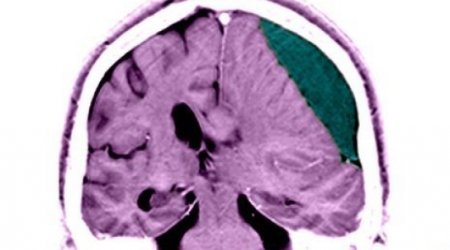 Brain blow leaves life-long dangers