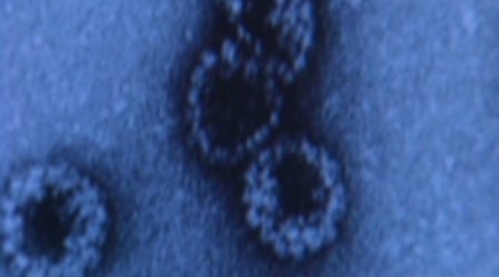 Imminent global cancer 'disaster' reflects aging