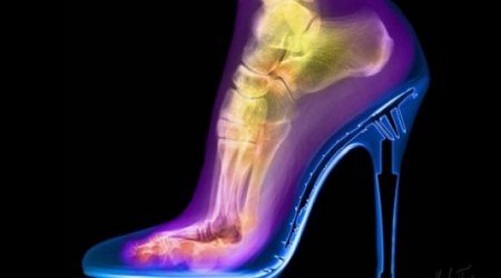 X-ray photography that shows the world in a whole new light