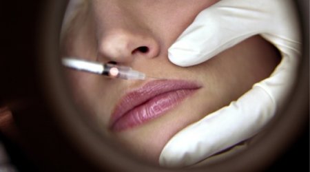 Is cosmetic surgery now a normal part of modern life?