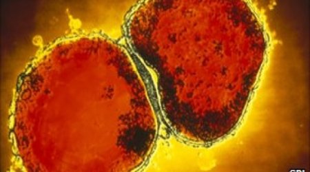 Lasers used in meningitis tests by Strathclyde University scientists