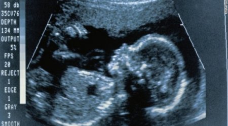 'Putting the next generation of brains in danger'