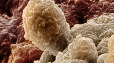 DNA prostate test 'will predict deadliest cancer risk'