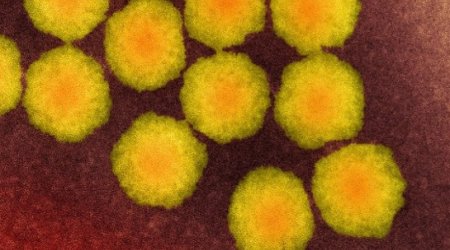 Rare 'polio-like' disease reports