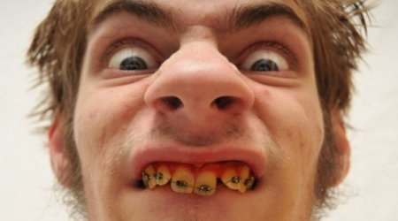 Why wannabe brides pick an ugly husband