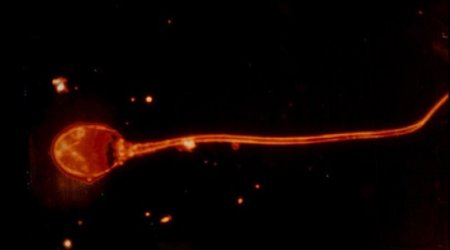 Gentlemen, your sperm is under attack – but don't panic