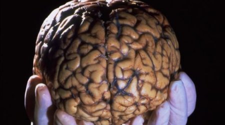 How building a library of brains could save lives