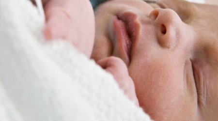 C-section birth "link to later obesity"