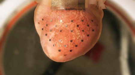 Electronic sleeve that fits over your heart to keep it beating for ever