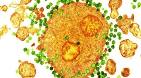Immune upgrade gives 'HIV shielding'