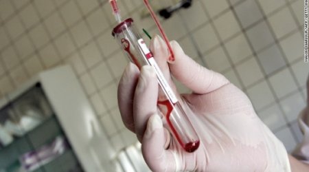 Second baby possibly 'cured' of HIV