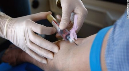 Test may some day predict 5-year risk of death