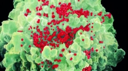 Rare 'likely' female-to-female HIV case reported