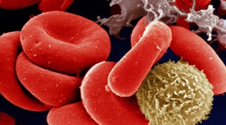 Thousands of healthy people wrongly told they have cancer